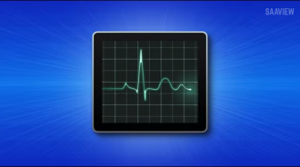 How to Speed Up a Slow Laptop in 2025 Simple Fixes That Actually Work